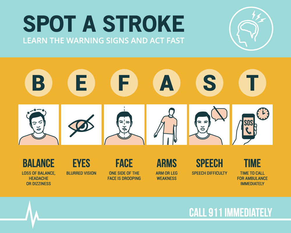 BE FAST - Stroke Detection And Prevention | Semmes Murphey Clinic