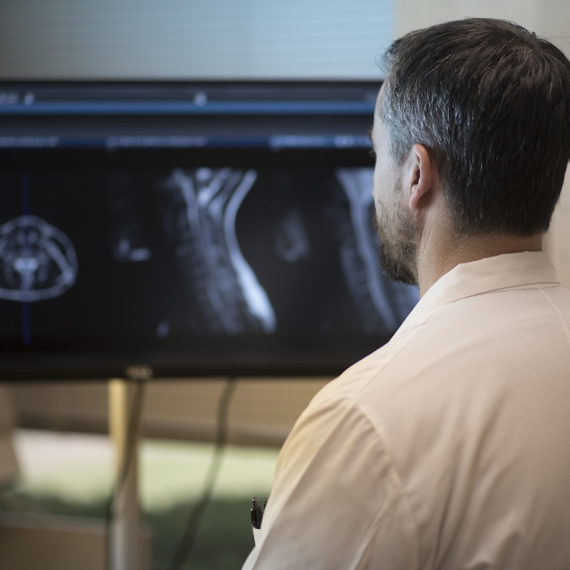 Back of a doctor's head looking at X-rays on a computer