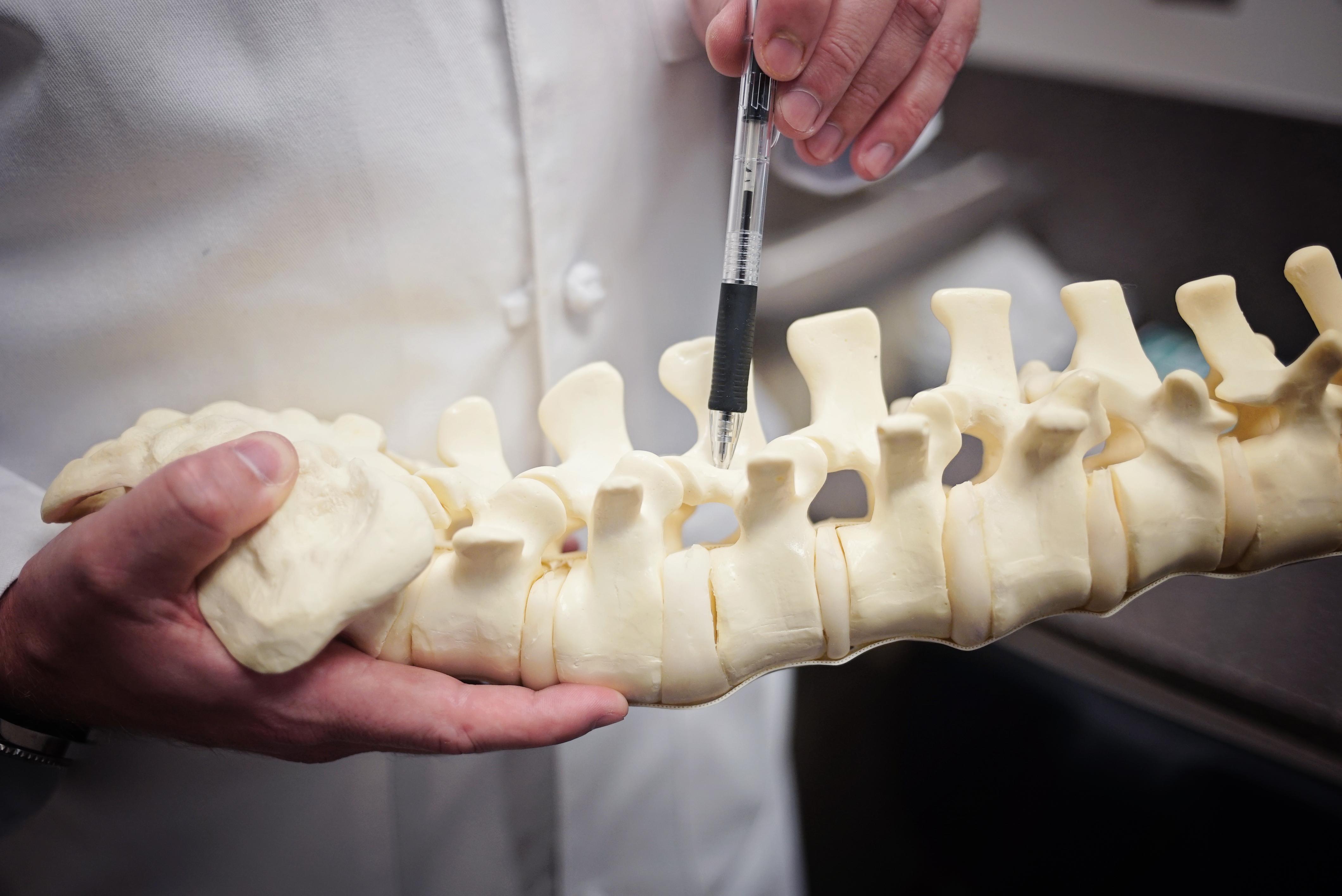 Doctor hands gesturing to a spine model with a pen